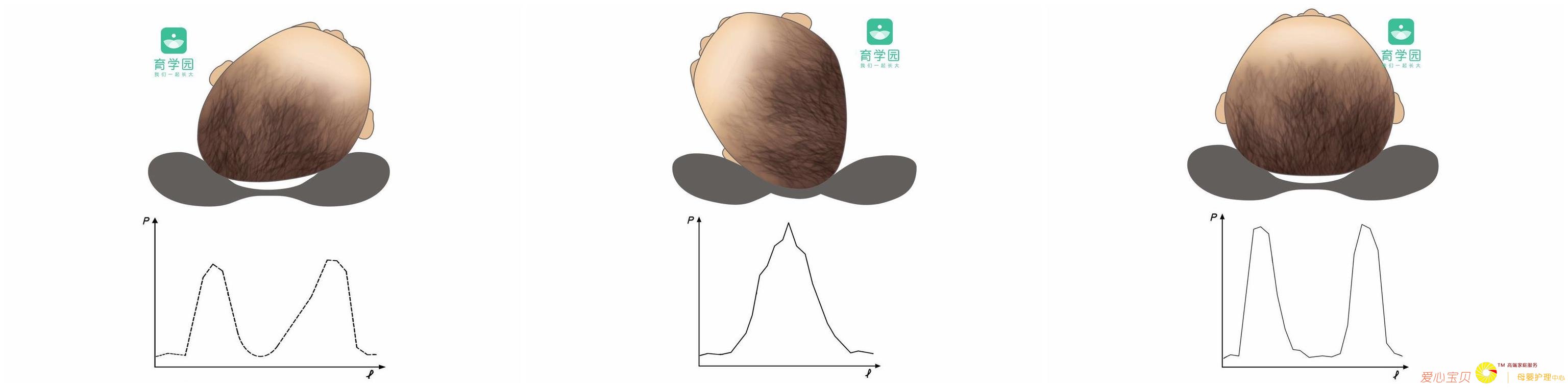 ����˯ƫͷ��ֹӰ�����ۣ����صľ�Ȼ��Ӱ�콡����